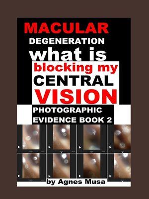 cover image of Macular Degeneration, What Is Blocking My Central Vision, Photographic Evidence Book 2